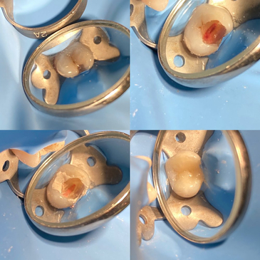 Slider image (6) Easy Dental